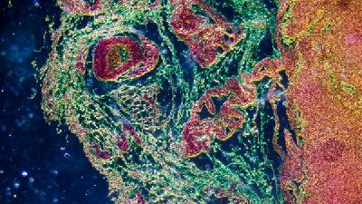 新冠肺炎是如何形成的 新冠病毒侵害身体的过程是什么