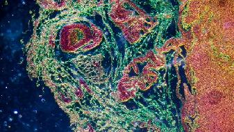 新冠肺炎是如何形成的 新冠病毒侵害身体的过程是什么