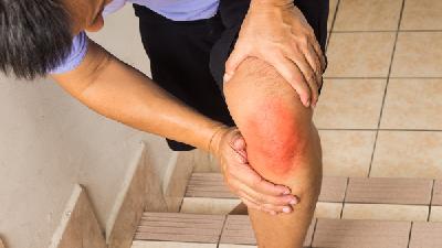 膝关节炎会威胁生命吗
