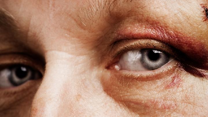 引起近视眼的病因主要有哪些呢