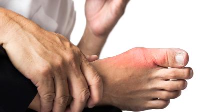 伤肢肿胀是主要的患有软组织损伤的症状表现