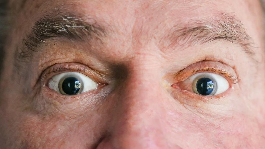 牵引性视网膜脱离如何诊断