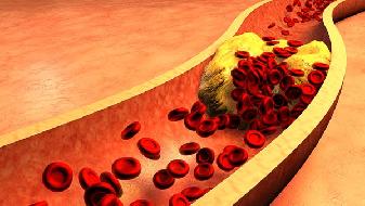 感染德尔塔一般几天出现症状 德尔塔变异毒株有什么新特点