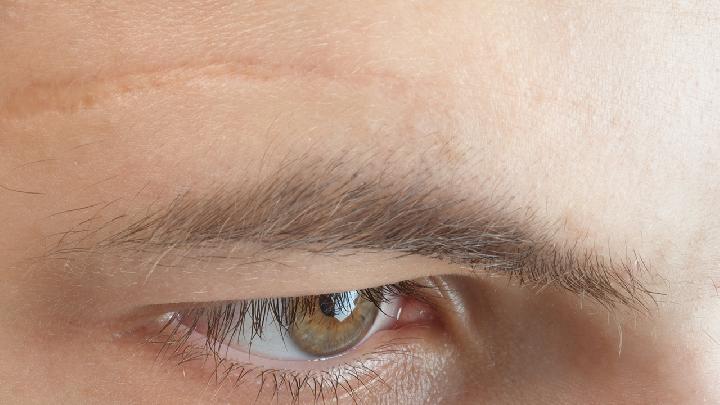男士脸上有黑斑是什么原因 或和这几种因素有关