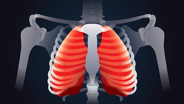 继发性肺结核严重吗 继发性肺结核常见的分型都有哪些