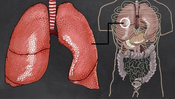 肺结核如何康复 肺结核的调理方法都有哪些