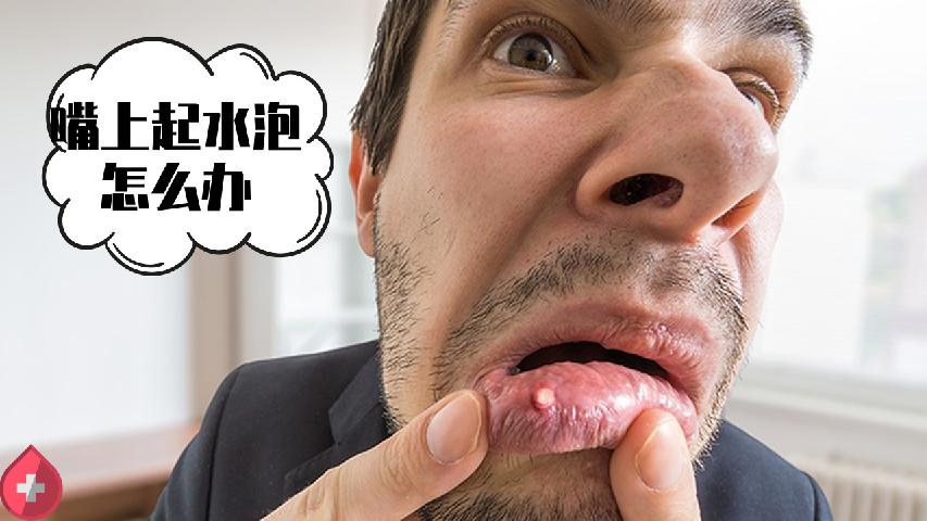 口臭的常见原因有哪些 导致口臭五大常见原因