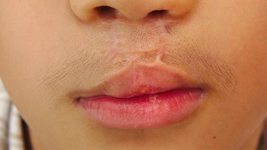 冬日护唇保湿全攻略 避免5个坏习惯护双唇