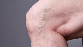 男人前列腺增生的危害有哪些 男人前列腺增生存5大危害