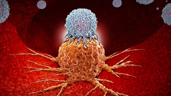 淋巴瘤化疗后能活多久 影响淋巴瘤化疗后生存期的因素都有哪些