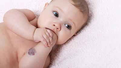 什么是新生儿生理性黄疸 新生儿黄疸是如何形成的?