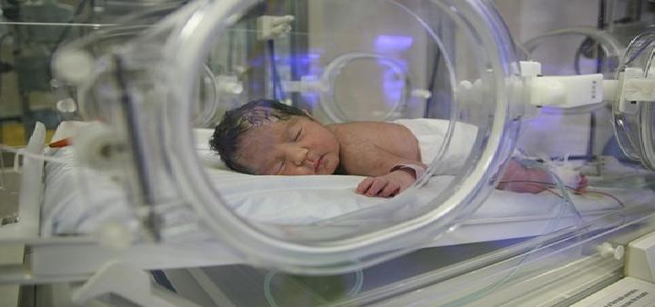 如何预防新生儿尿布疹 预防新生儿尿布疹的11建议