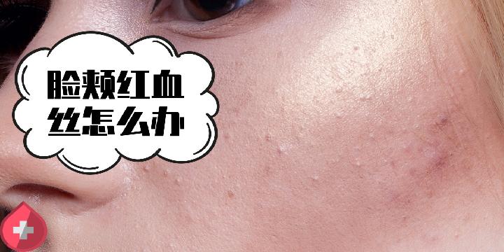 如何彻底卸妆防止皮肤提前衰老 做好五点无惧皮肤衰老
