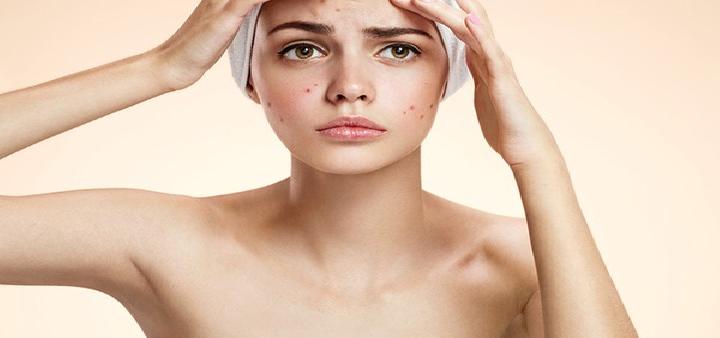 皮肤为什么容易出现红印子肌肤出现红印或许为3个原因导致