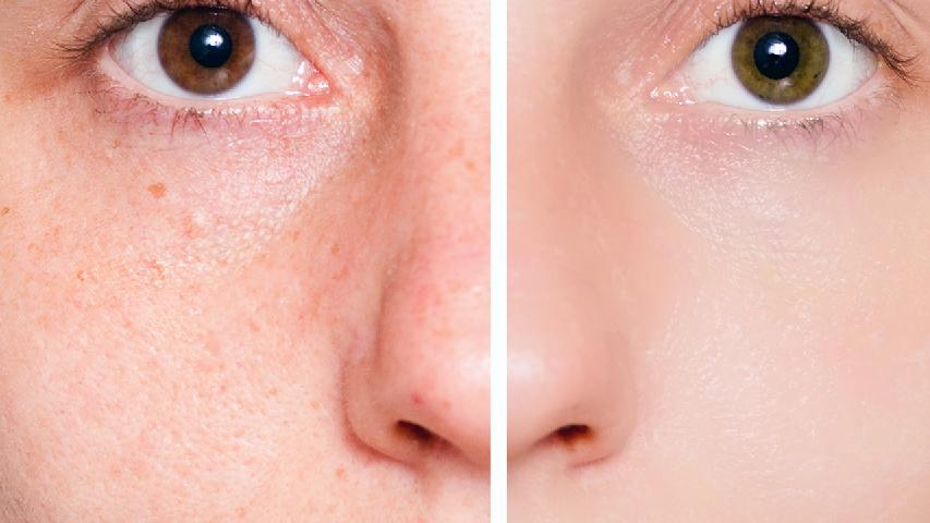 白醋洗脸对肌肤都有哪些功效 用白醋洗脸有四大美容功效
