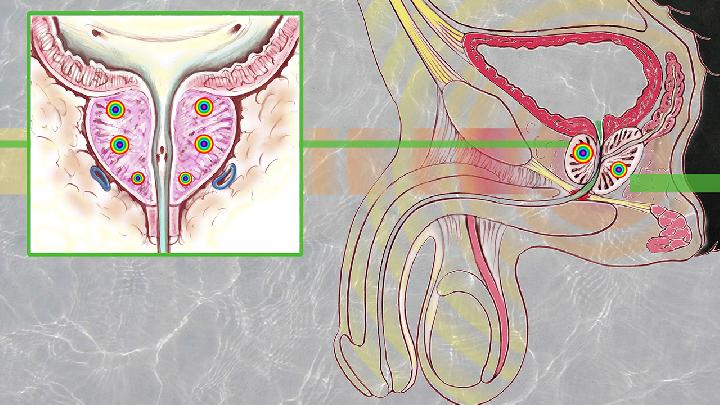 为什么男人易得前列腺疾病?男人前列腺疾病的危害有哪些?