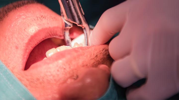牙龈萎缩怎么预防