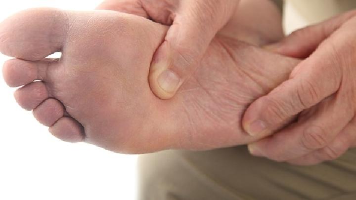 足跟瘀斑应该如何预防
