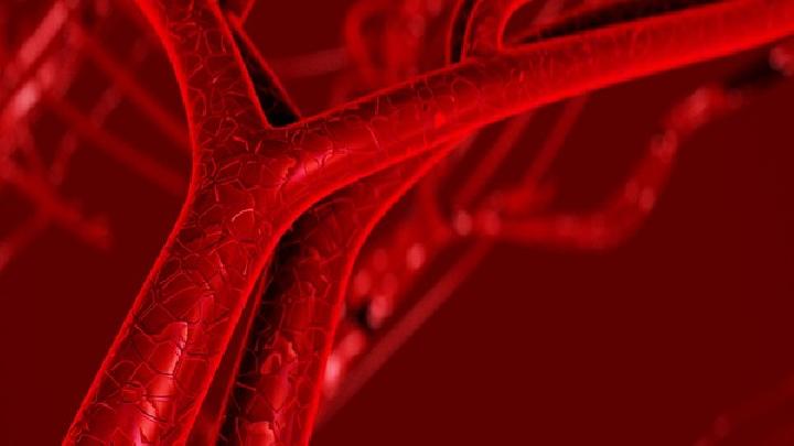 患有深静脉血栓对生活有影响吗