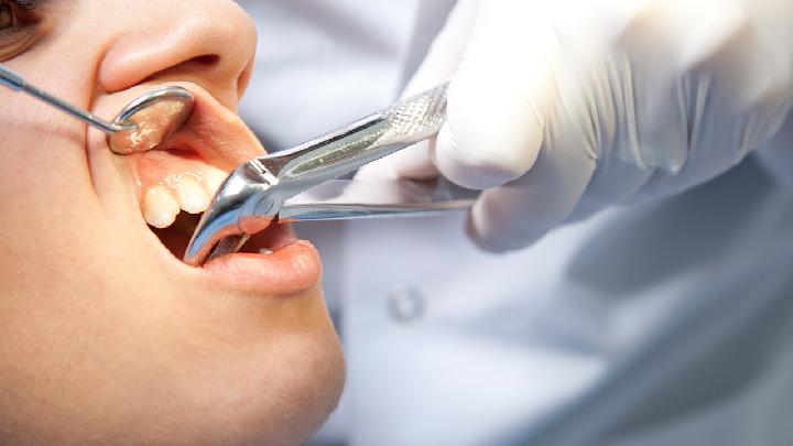 牙龈出血溃疡可能是牙龈癌引发的