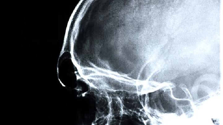 早期脑瘫的检查和诊断