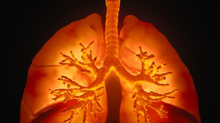 聚集肺癌如何逃脱肺癌的魔爪