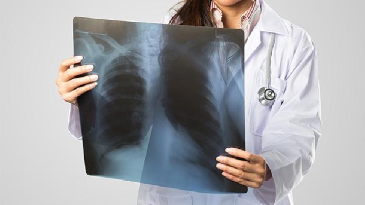 右肺肺癌晚期治疗一个月症状控制胸水消失