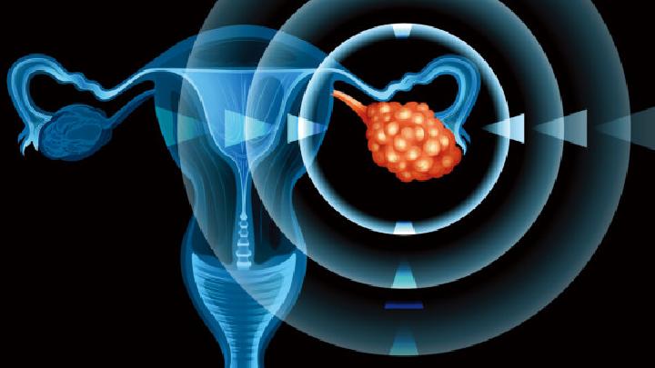 五种宫颈癌的病因