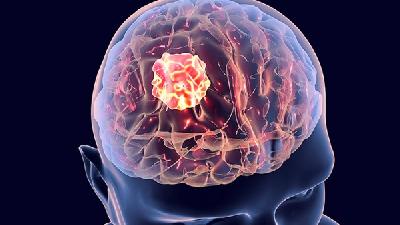 早期恶性脑癌能治好吗？
