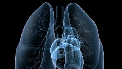 什么事中央型肺癌？