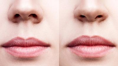 鼻咽癌应该如何预防?