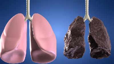 哪些因素可引起肺癌