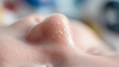 解密过敏性鼻炎怎么治疗!