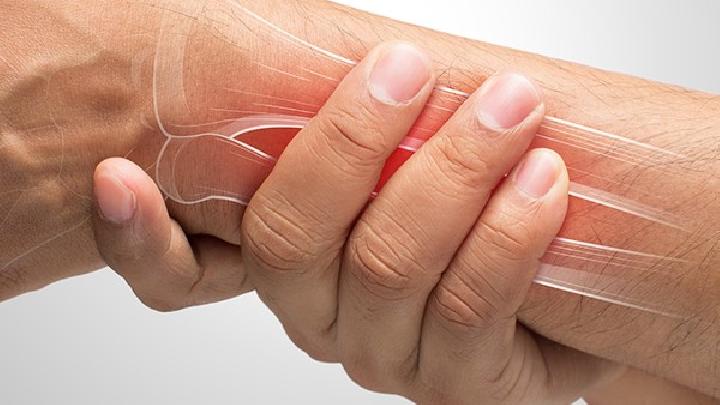 手腕腱鞘炎有哪些常见症状?