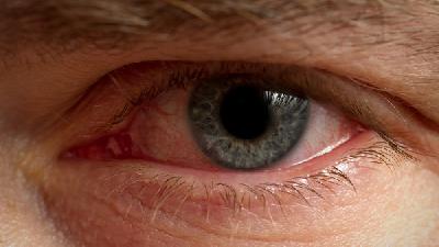 青光眼术后会引起哪些并发症