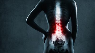 如何预防先天性脊柱畸形