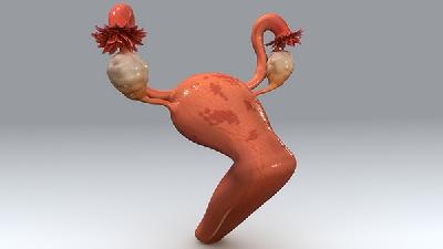 三大因素導(dǎo)致卵巢囊腫高發(fā)