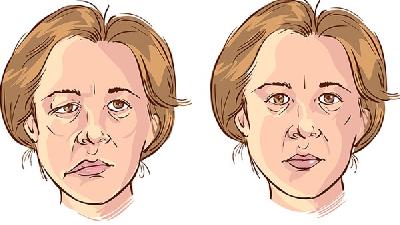 不应忽视小细节谨防过敏性鼻炎