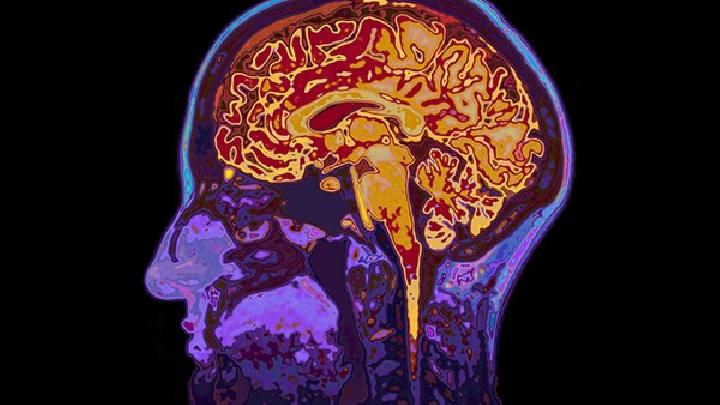 脑萎缩发病的是有哪些因素引起的呢?