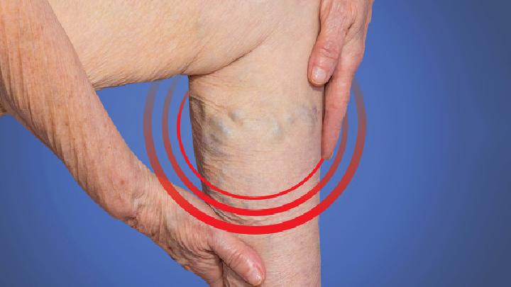 下肢静脉曲张有哪些病因?