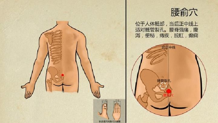 腰间盘突出有哪些临床表现呢?