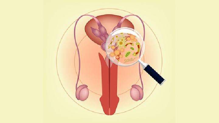 有关卵巢囊肿的检查主要有哪些