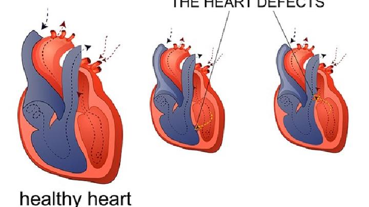 风湿性心脏病有哪些症状表现?