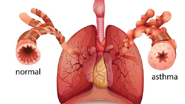 带您了解哮喘的主要症状