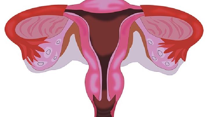 卵巢囊肿的种类有多少种呢