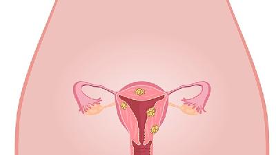 卵巢囊肿会引起哪些早期症状呢?