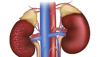 肾炎的早期症状有什么呢