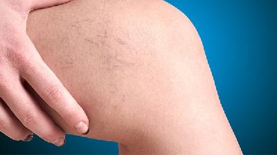 了解股骨头坏死的原因有哪些