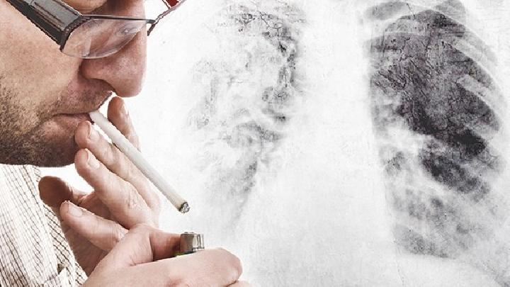 遏制肺癌从戒烟开始