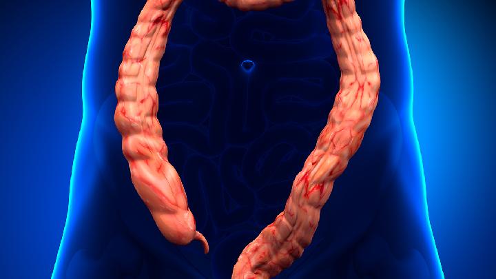 肠道疾病是导致结肠癌的原因之一